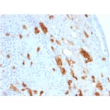 Immunohistochemistry - Anti-Calretinin Antibody [CALB2/2807] (A250376) - Antibodies.com