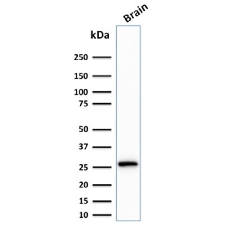 Western Blot - Anti-Calretinin Antibody [CALB2/2807] (A250376) - Antibodies.com