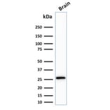 Western Blot - Anti-Calretinin Antibody [CALB2/2807] (A250376) - Antibodies.com