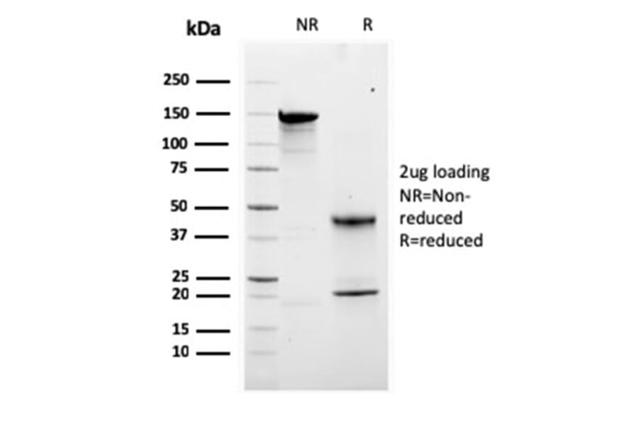 SDS-PAGE - Anti-Calretinin Antibody [CALB2/2807] (A250376) - Antibodies.com