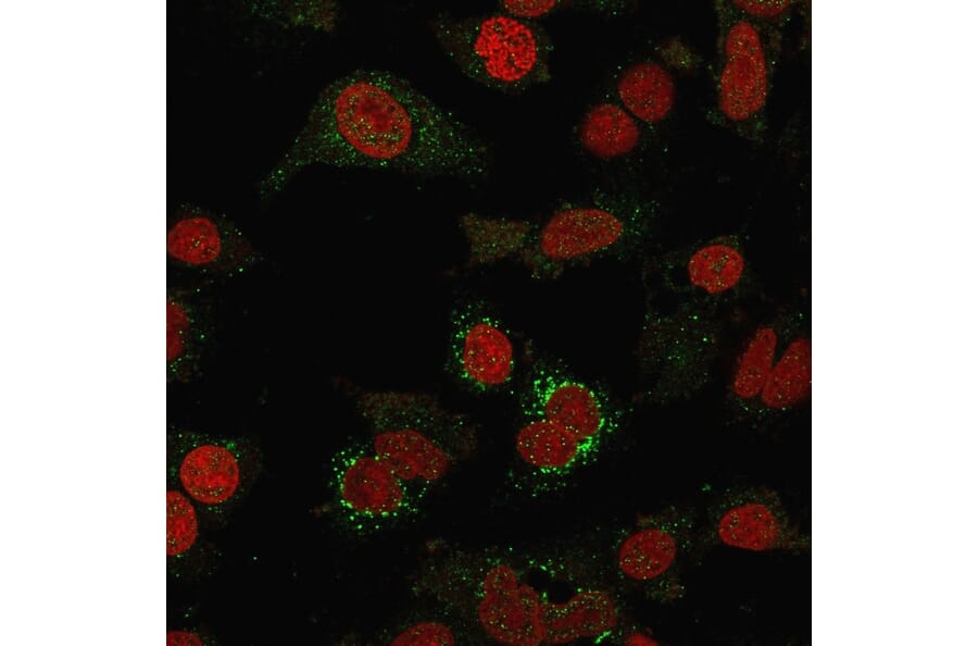 Immunofluorescence - Anti-B7H4 Antibody [B7H4/1788] (A250377) - Antibodies.com