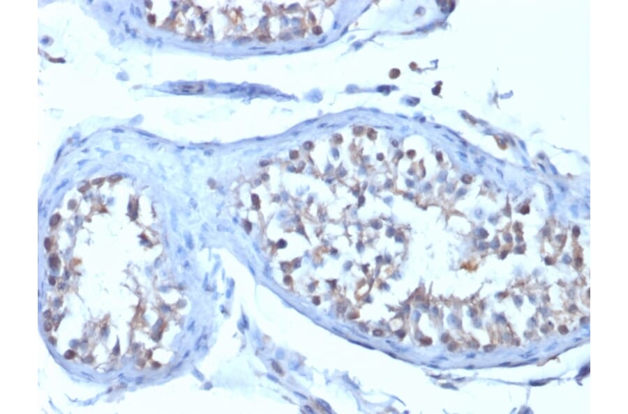 Immunohistochemistry - Anti-B7H4 Antibody [B7H4/1788] (A250377) - Antibodies.com