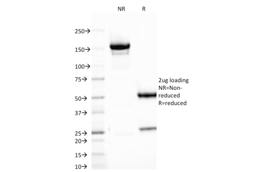 SDS-PAGE - Anti-B7H4 Antibody [B7H4/1788] (A250377) - Antibodies.com