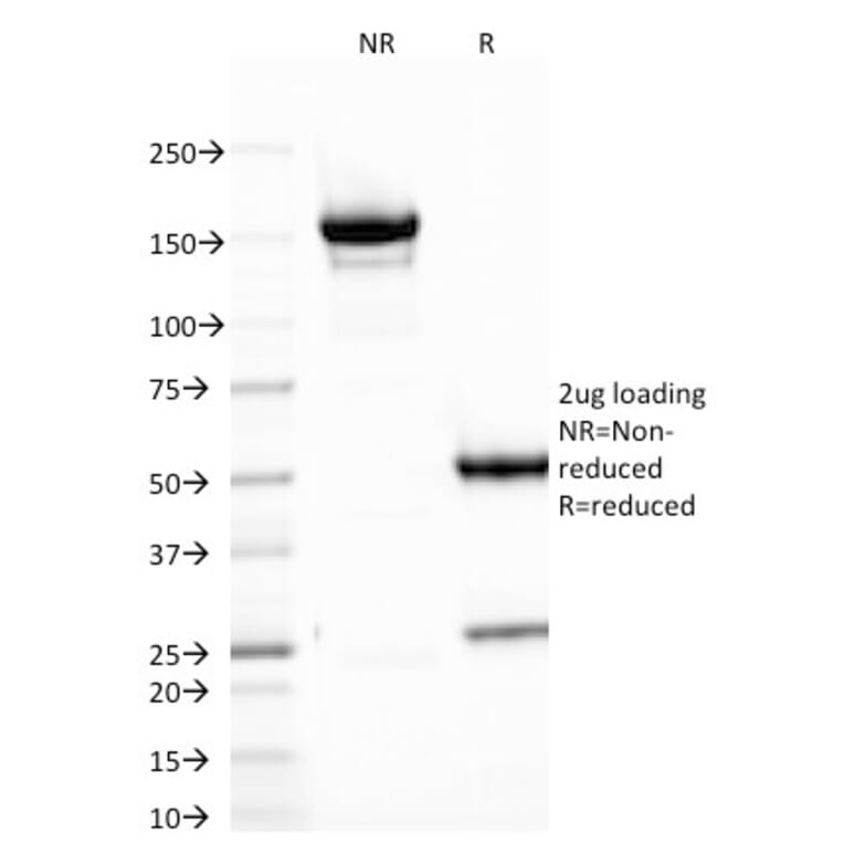 SDS-PAGE - Anti-B7H4 Antibody [B7H4/1788] (A250377) - Antibodies.com