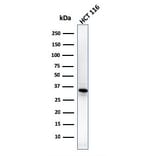 Western Blot - Anti-B7H4 Antibody [B7H4/1788] (A250377) - Antibodies.com