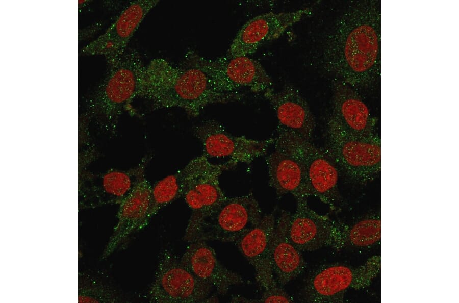 Immunofluorescence - Anti-B7H4 Antibody [B7H4/2652R] (A250378) - Antibodies.com