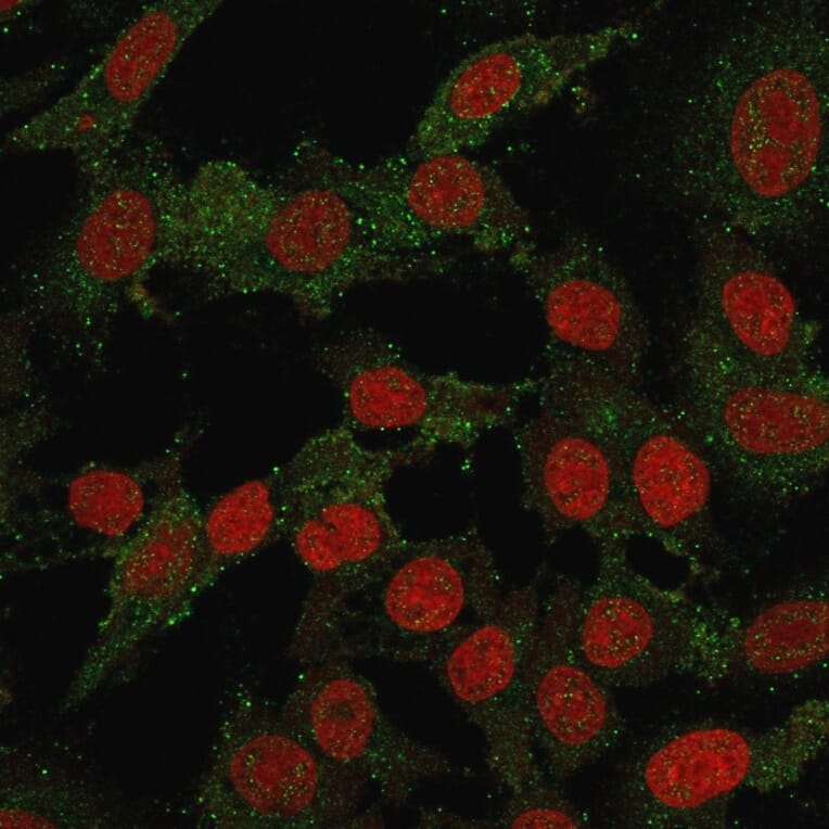 Immunofluorescence - Anti-B7H4 Antibody [B7H4/2652R] (A250378) - Antibodies.com