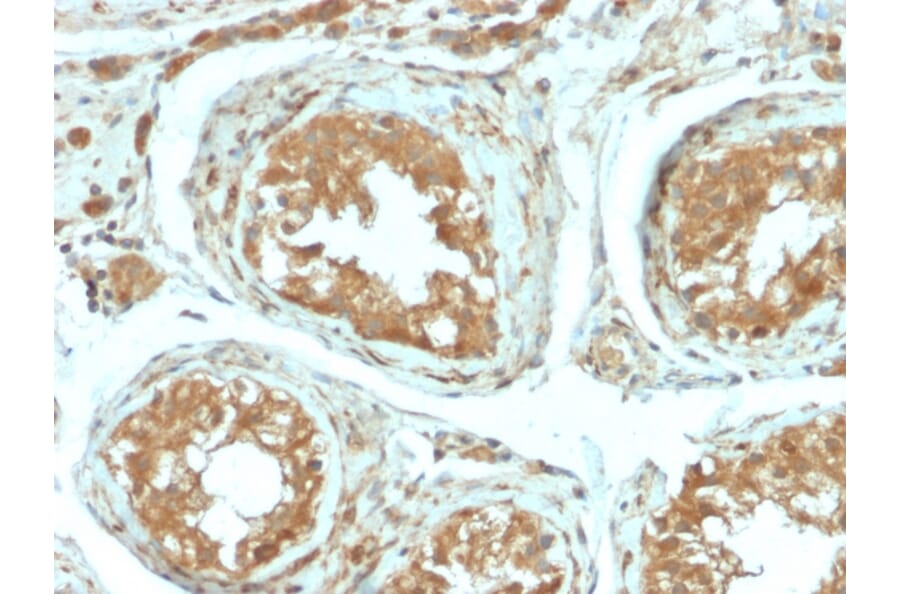 Immunohistochemistry - Anti-B7H4 Antibody [B7H4/2652R] (A250378) - Antibodies.com