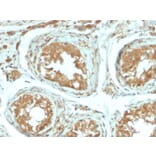 Immunohistochemistry - Anti-B7H4 Antibody [B7H4/2652R] (A250378) - Antibodies.com