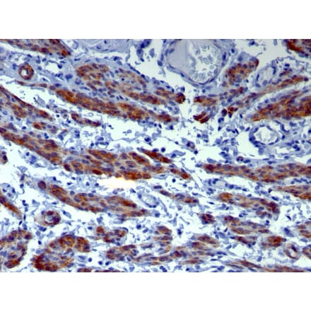 Immunohistochemistry - Anti-Caldesmon Antibody [h-CALD] (A250379) - Antibodies.com