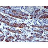 Immunohistochemistry - Anti-Caldesmon Antibody [h-CALD] (A250379) - Antibodies.com