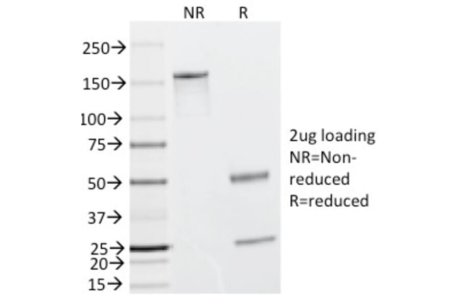 SDS-PAGE - Anti-Caldesmon Antibody [h-CALD] (A250380) - Antibodies.com