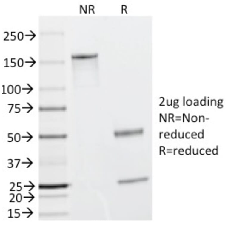 SDS-PAGE - Anti-Caldesmon Antibody [h-CALD] (A250380) - Antibodies.com