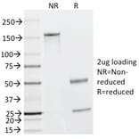 SDS-PAGE - Anti-Caldesmon Antibody [h-CALD] (A250380) - Antibodies.com