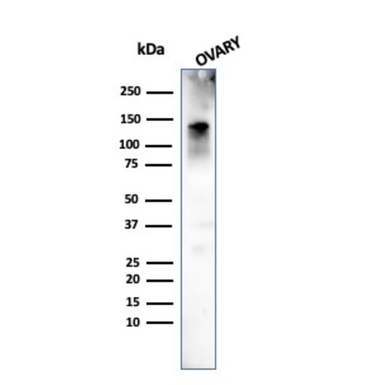 Western Blot - Anti-Caldesmon Antibody [h-CALD] (A250380) - Antibodies.com