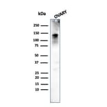 Western Blot - Anti-Caldesmon Antibody [h-CALD] (A250380) - Antibodies.com