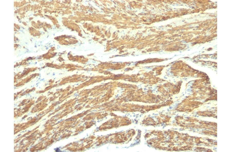 Immunohistochemistry - Anti-Caldesmon Antibody [SPM168] (A250380) - Antibodies.com