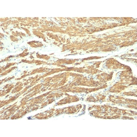 Immunohistochemistry - Anti-Caldesmon Antibody [SPM168] (A250380) - Antibodies.com