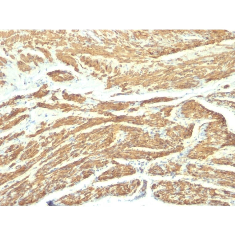 Immunohistochemistry - Anti-Caldesmon Antibody [SPM168] (A250380) - Antibodies.com