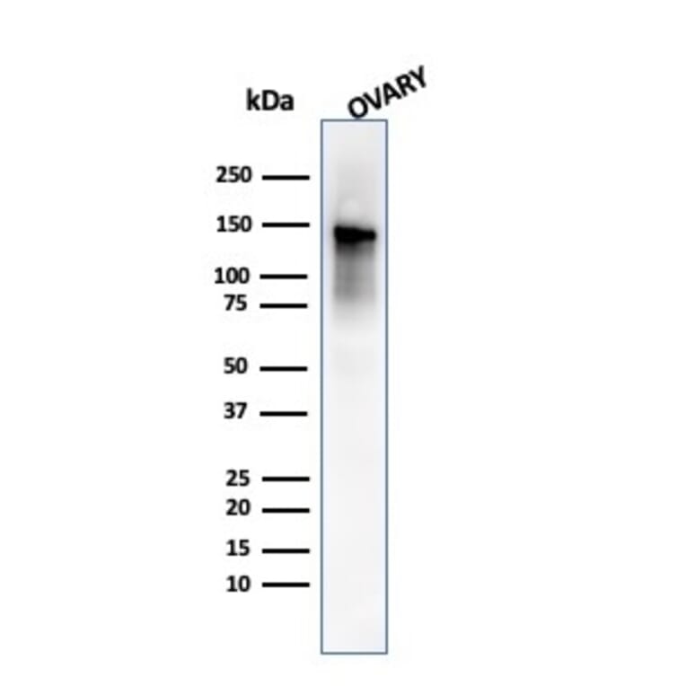 Western Blot - Anti-Caldesmon Antibody [SPM168] (A250381) - Antibodies.com