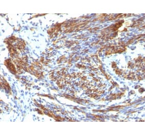 Immunohistochemistry - Anti-Caldesmon Antibody [CALD1/820] (A250381) - Antibodies.com