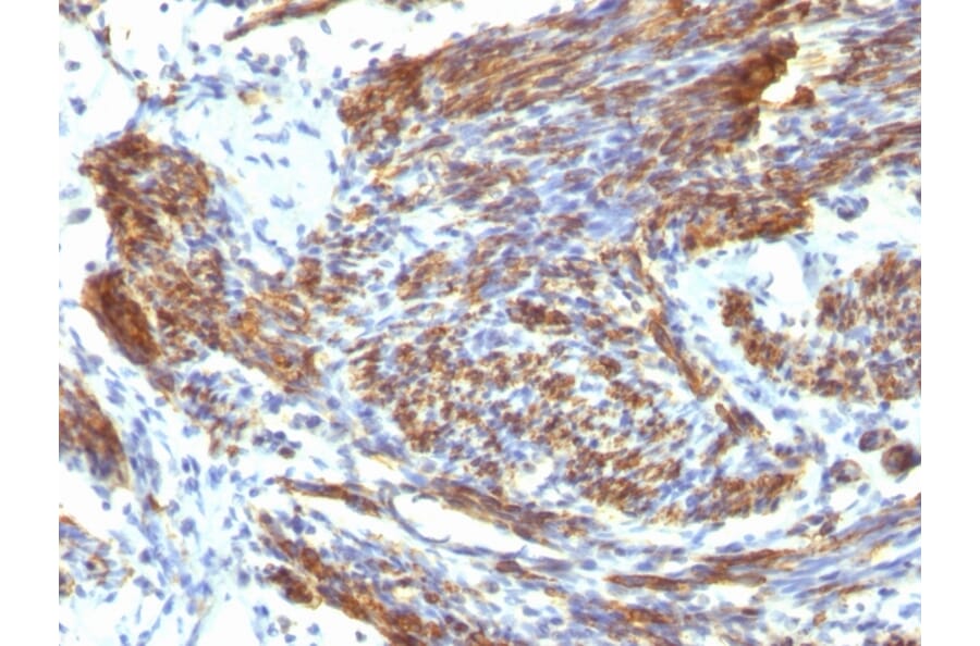 Immunohistochemistry - Anti-Caldesmon Antibody [CALD1/820] (A250381) - Antibodies.com