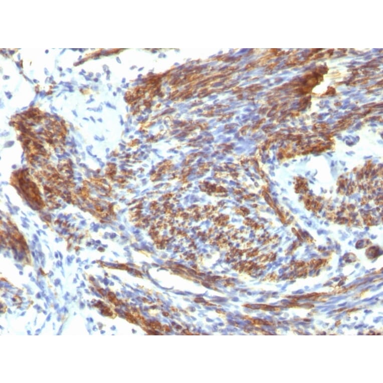 Immunohistochemistry - Anti-Caldesmon Antibody [CALD1/820] (A250381) - Antibodies.com