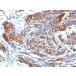 Immunohistochemistry - Anti-Caldesmon Antibody [CALD1/820] (A250381) - Antibodies.com