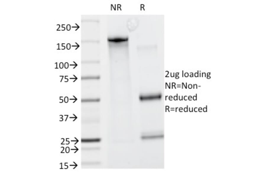 SDS-PAGE - Anti-Caldesmon Antibody [CALD1/820] (A250382) - Antibodies.com