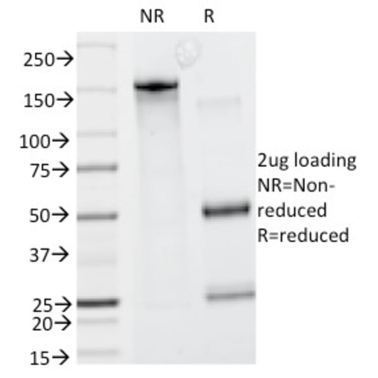 SDS-PAGE - Anti-Caldesmon Antibody [CALD1/820] (A250382) - Antibodies.com