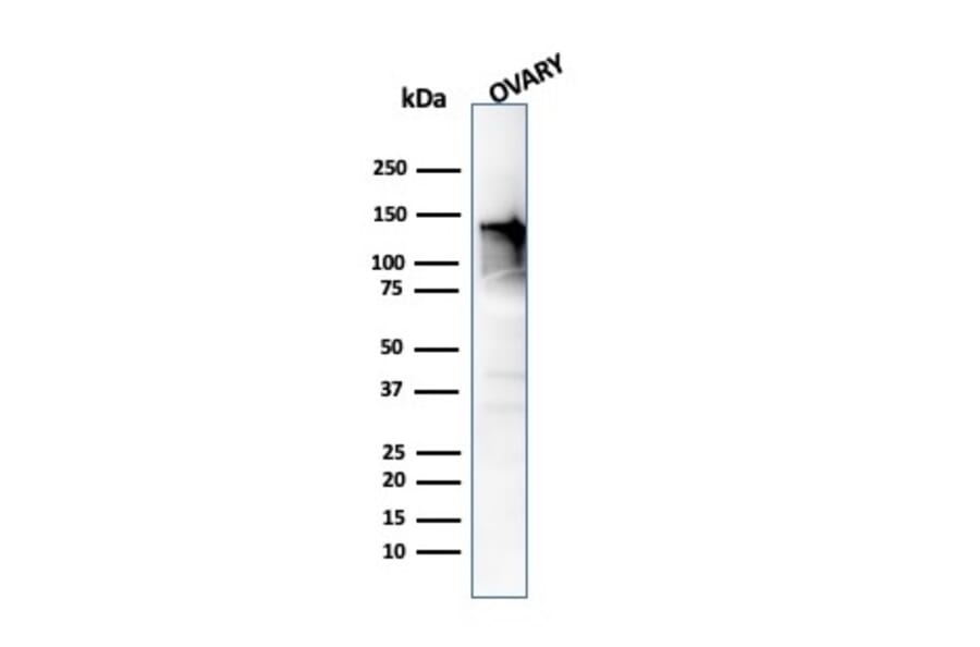 Western Blot - Anti-Caldesmon Antibody [CALD1/820] (A250382) - Antibodies.com