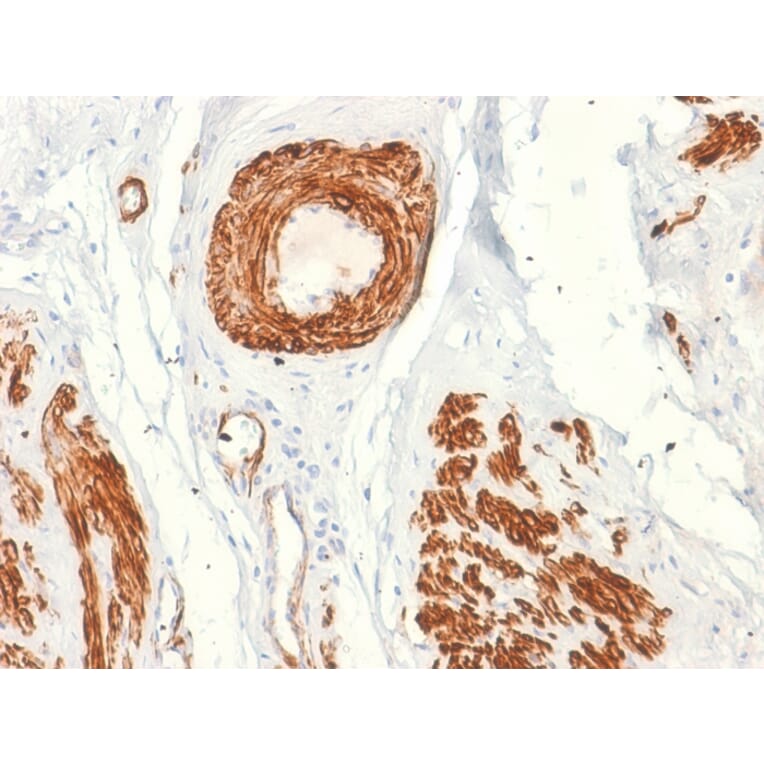 Immunohistochemistry - Anti-Caldesmon Antibody [rCALD1/820] (A250383) - Antibodies.com