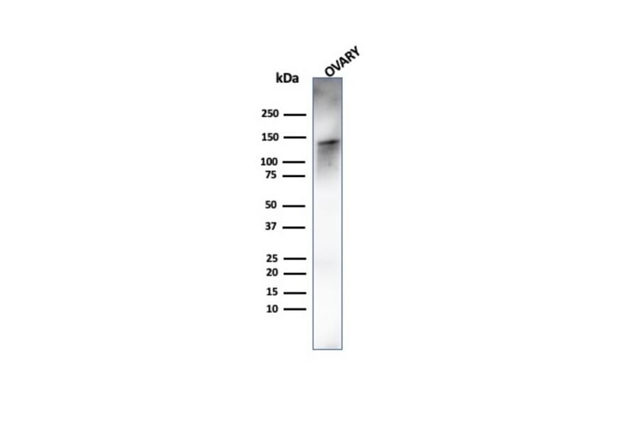 Western Blot - Anti-Caldesmon Antibody [rCALD1/820] (A250384) - Antibodies.com