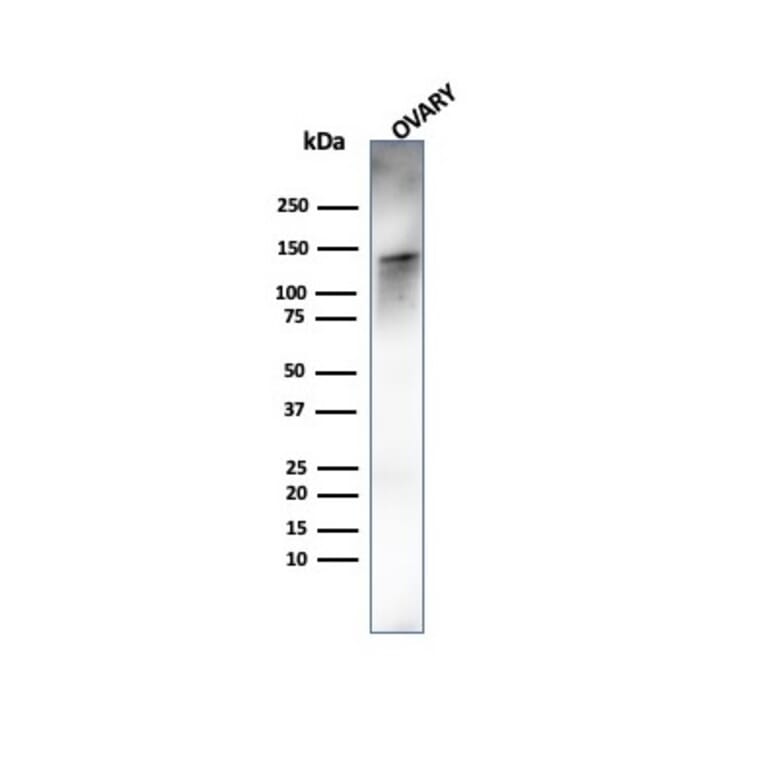 Western Blot - Anti-Caldesmon Antibody [rCALD1/820] (A250384) - Antibodies.com