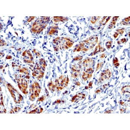 Immunohistochemistry - Anti-Caldesmon Antibody [CALD1/1424R] (A250384) - Antibodies.com
