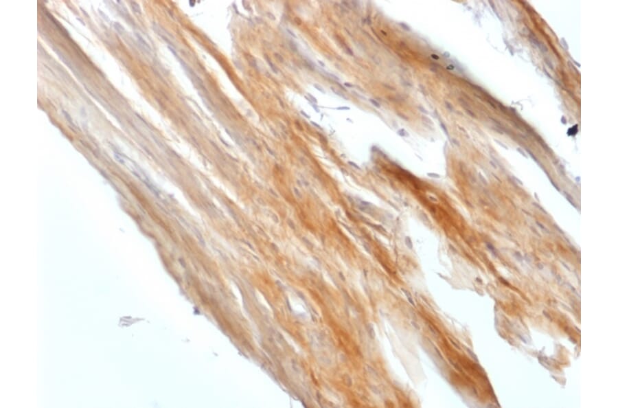 Immunohistochemistry - Anti-Caldesmon Antibody [CALD1/1424R] (A250385) - Antibodies.com