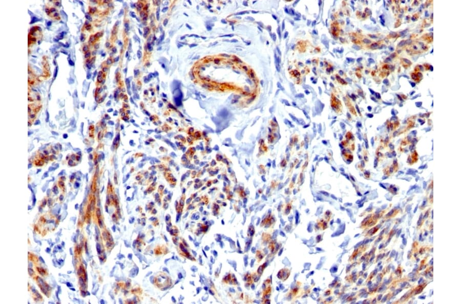 Immunohistochemistry - Anti-Caldesmon Antibody (A250385) - Antibodies.com