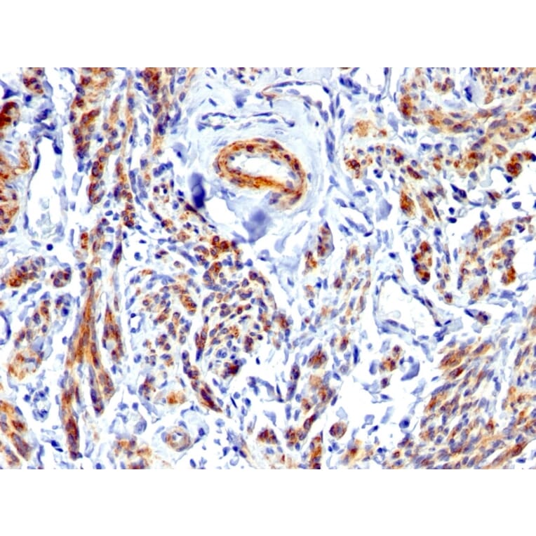 Immunohistochemistry - Anti-Caldesmon Antibody (A250385) - Antibodies.com