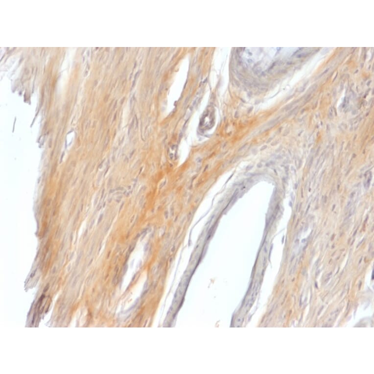 Immunohistochemistry - Anti-Caldesmon Antibody (A250386) - Antibodies.com