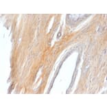 Immunohistochemistry - Anti-Caldesmon Antibody (A250386) - Antibodies.com