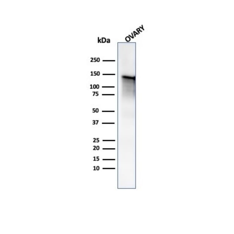 Western Blot - Anti-Caldesmon Antibody (A250386) - Antibodies.com