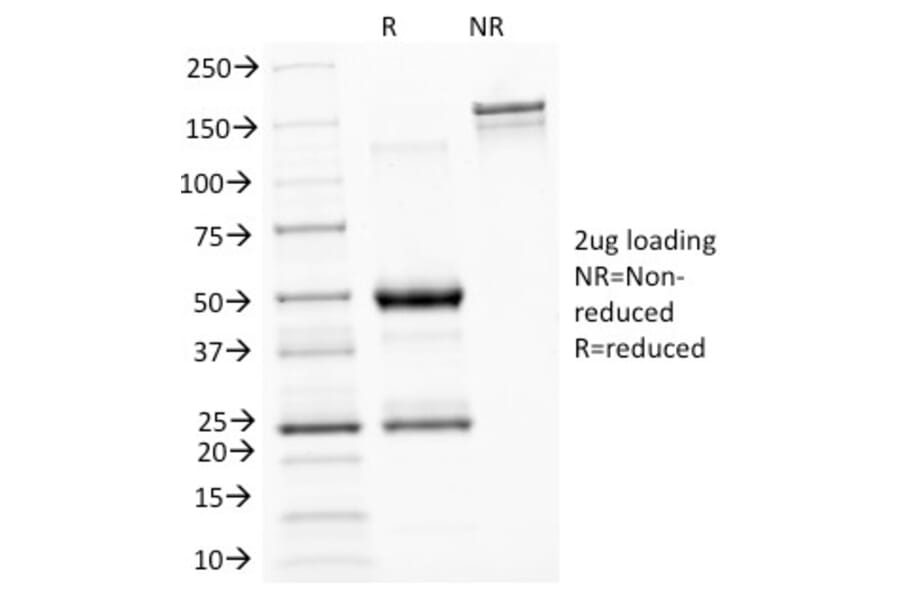 SDS-PAGE - Anti-ASRGL1 Antibody [CRASH/1289] (A250387) - Antibodies.com