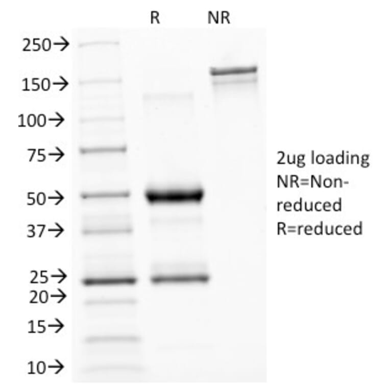 SDS-PAGE - Anti-ASRGL1 Antibody [CRASH/1289] (A250387) - Antibodies.com