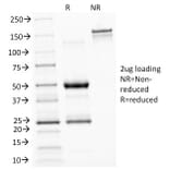 SDS-PAGE - Anti-ASRGL1 Antibody [CRASH/1289] (A250387) - Antibodies.com