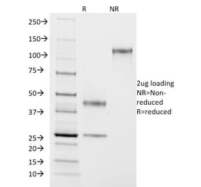 SDS-PAGE - Anti-ASRGL1 Antibody [CRASH/1290] (A250387) - Antibodies.com