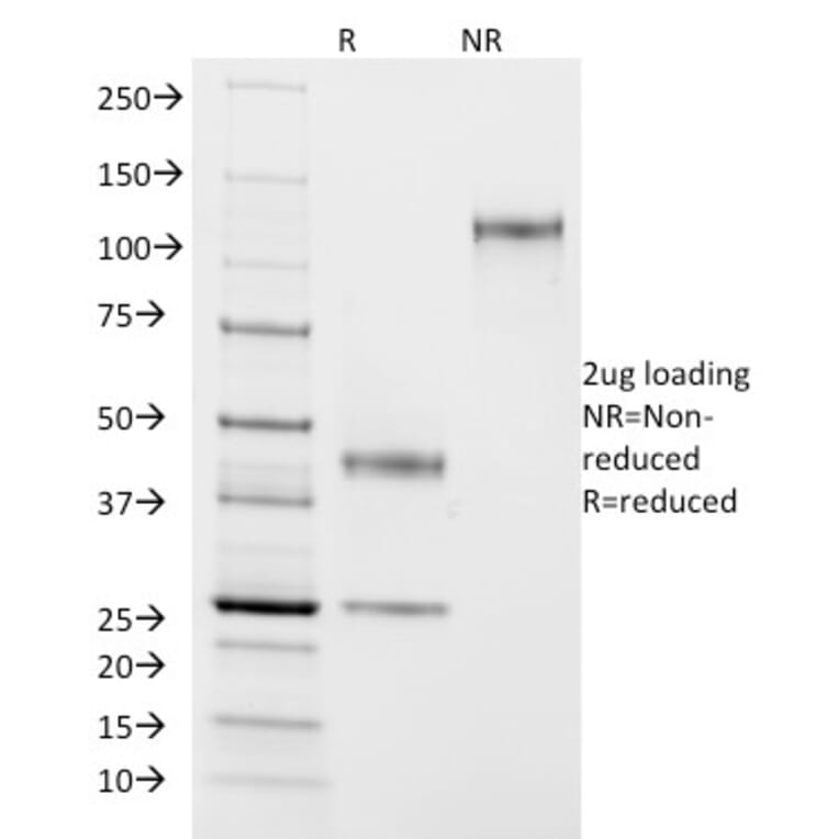 SDS-PAGE - Anti-ASRGL1 Antibody [CRASH/1290] (A250387) - Antibodies.com