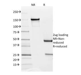 SDS-PAGE - Anti-PD-L2 Antibody [PDL2/1850] (A250389) - Antibodies.com