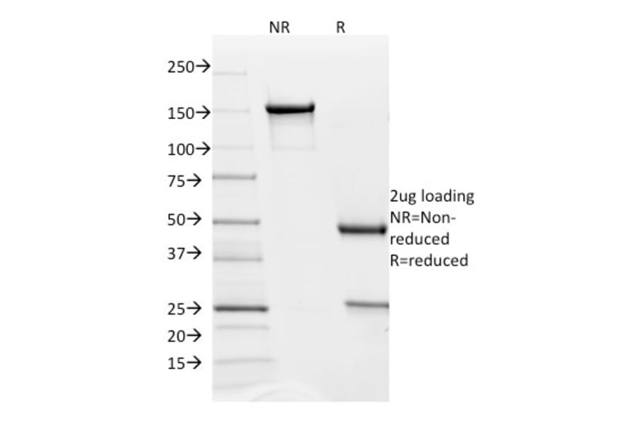 SDS-PAGE - Anti-PD-L2 Antibody [PDL2/1850] (A250389) - Antibodies.com