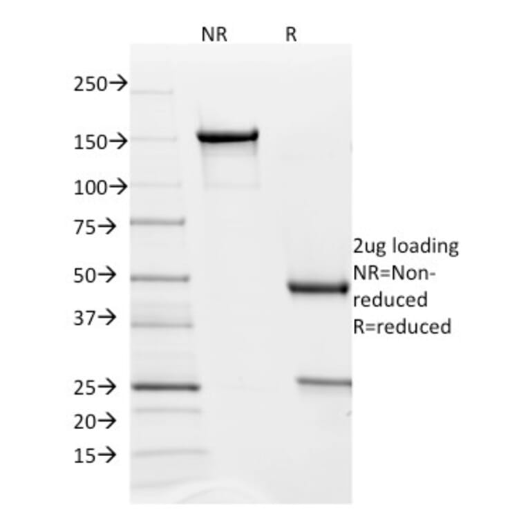 SDS-PAGE - Anti-PD-L2 Antibody [PDL2/1850] (A250389) - Antibodies.com