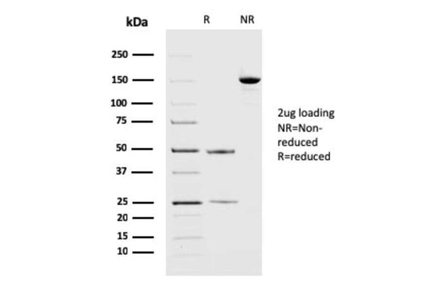 SDS-PAGE - Anti-PD-L2 Antibody [PDL2/2676] (A250390) - Antibodies.com